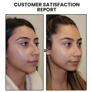 (🔥LAST DAY SALE-50% OFF) Skavix™ Miniyou Lymphatic Drainage Earrings