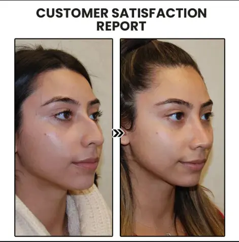 (🔥LAST DAY SALE-50% OFF) Skavix™ Miniyou Lymphatic Drainage Earrings