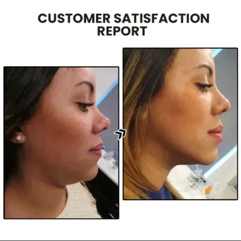 (🔥LAST DAY SALE-50% OFF) Skavix™ Miniyou Lymphatic Drainage Earrings