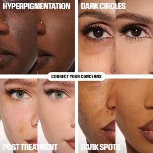 ✨ LAST DAY BUY 1 GET 1 FREE✨Skavix™ Calcium Dark Spot Eye Cream | Dark Circle, Anti-aging, Sagging, Elasticity