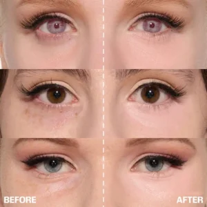 ✨ LAST DAY BUY 1 GET 1 FREE✨Skavix™ Calcium Dark Spot Eye Cream | Dark Circle, Anti-aging, Sagging, Elasticity