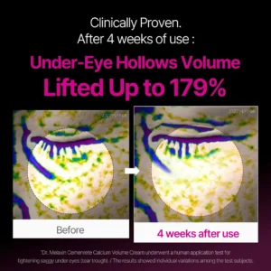 ✨ LAST DAY BUY 1 GET 1 FREE✨Skavix™ Calcium Dark Spot Eye Cream | Dark Circle, Anti-aging, Sagging, Elasticity