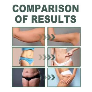 🔥Last DAY 70% OFF-Skavix® Collagen Oil – Firms Sagging Skin & Reduces Wrinkles Fast