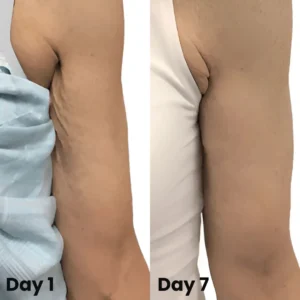 🔥Last DAY 70% OFF-Skavix® Collagen Oil – Firms Sagging Skin & Reduces Wrinkles Fast