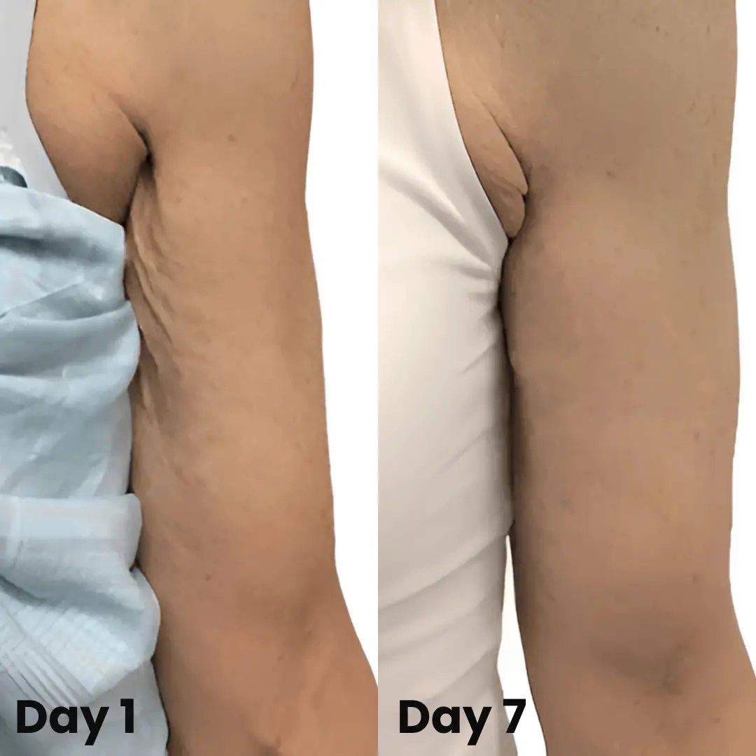 🔥Last DAY 70% OFF-Skavix® Collagen Oil – Firms Sagging Skin & Reduces Wrinkles Fast