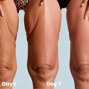 🔥Last DAY 70% OFF-Skavix® Collagen Oil – Firms Sagging Skin & Reduces Wrinkles Fast