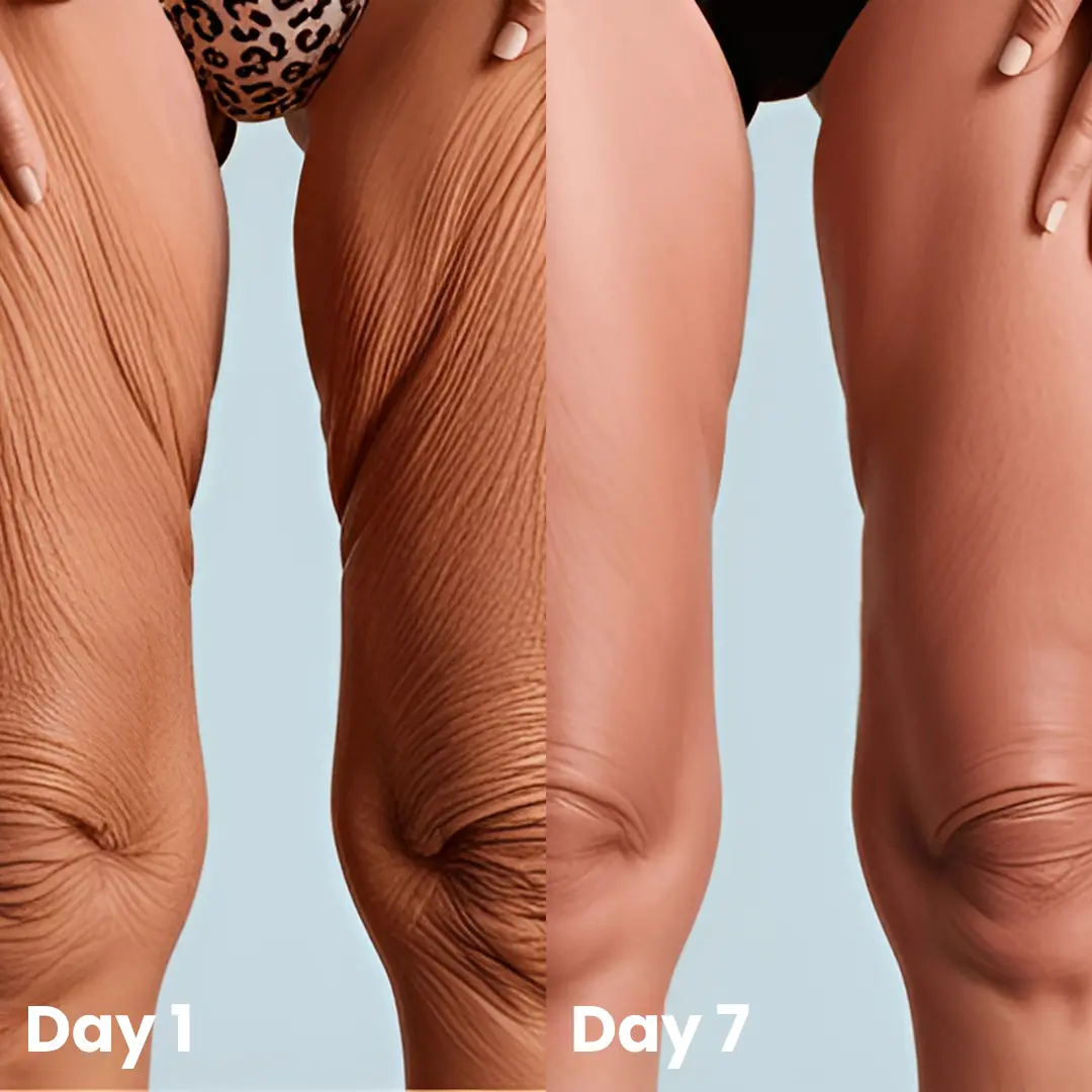 🔥Last DAY 70% OFF-Skavix® Collagen Oil – Firms Sagging Skin & Reduces Wrinkles Fast