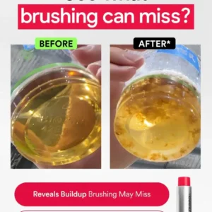 Skavix Stain Whitening Mouthwash for White Teeth, Freshens Breath
 – softfaceglow