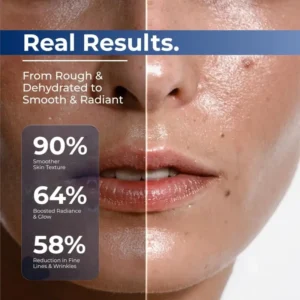 Skavix® 3% Hyaluronic Acid Ultra Hydrating Serum