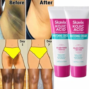 Skavix® Underarm Glow Reset Cream – Visibly Brighter, Smoother & More Even-Looking Skin
