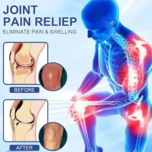 Skavix® Advanced Magnesium Pain Relief Cream